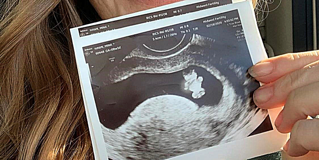 Водителката на добри коски, Мина Старсијак Хок е бремена со своето второ дете